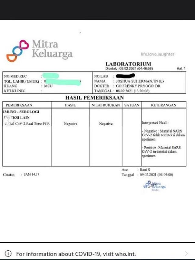 Joshua Suherman (Foto: Instagram/@jojosuherman)