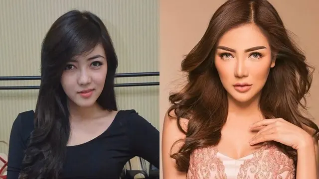 Seleb Ini Lakukan Operasi Hidung, Penampilan Terbaruya Bikin Pangling