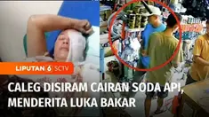 Sempat beredar berita di Tanah Datar, Sumatra Barat, tentang seorang calon anggota legislatif yang disiram air keras oleh lawan politiknya. Faktanya, sang caleg disiram cairan soda api oleh suami sirinya yang terbakar cemburu.