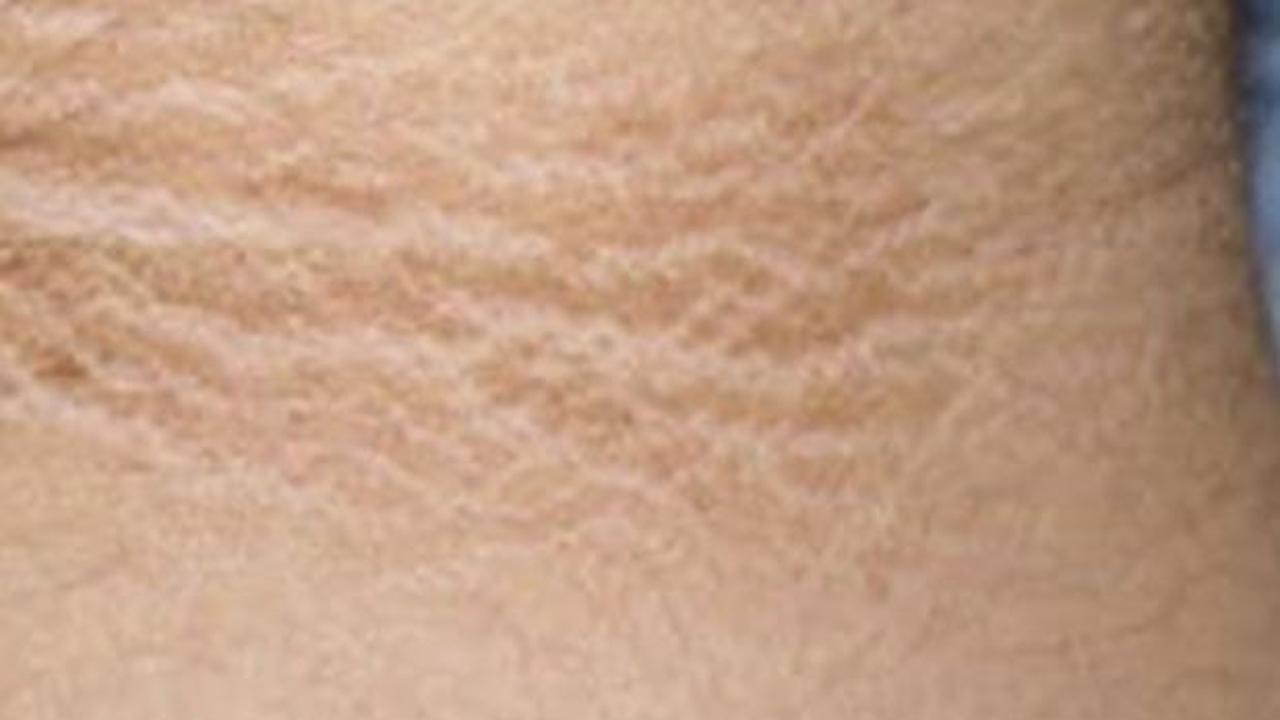 Cara Mengatasi Leher Hitam dengan Menggunakan Skincare