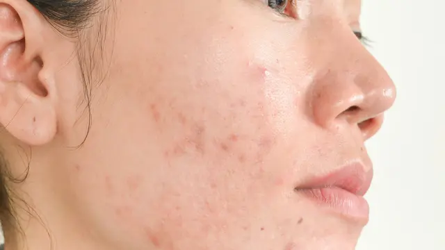 Bahan Kosmetik yang Perlu Dihindari Saat Hamil