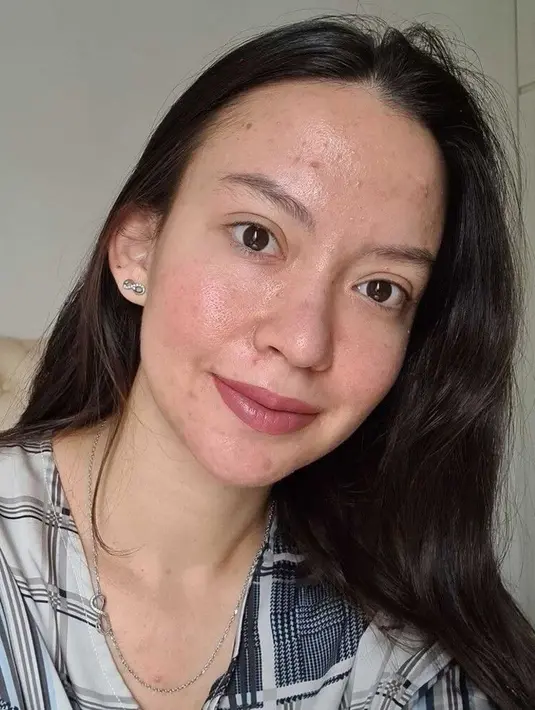 Karina Nadila ketika berjerawat (Instagram/karinanadila8921)