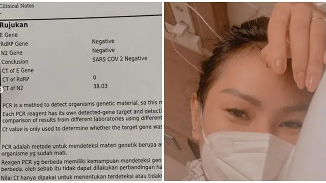 Dikabarkan Positif Covid-19, Kalina Ocktaranny Jelaskan Sakit Tifus