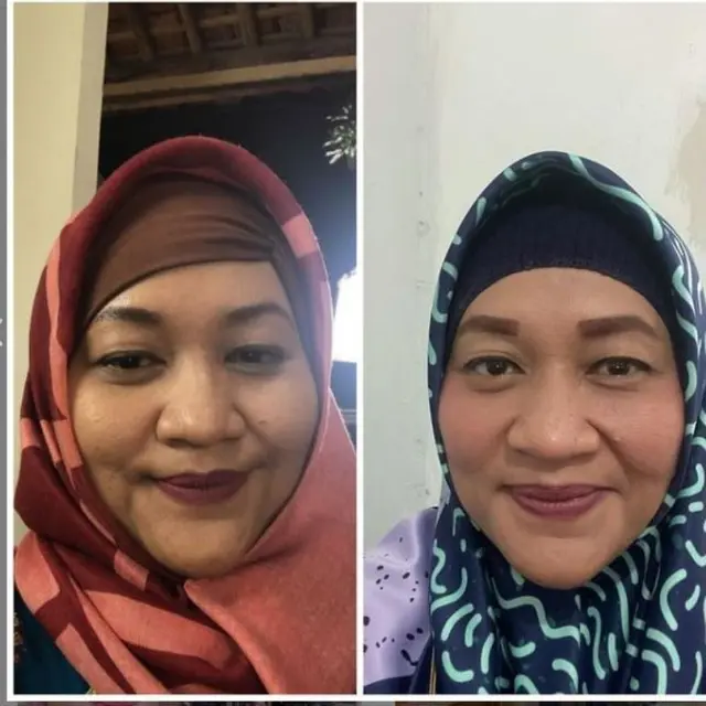 Berat Badan Turun 25 Kilogram, Ukuran Baju Tike Priatnakusumah Berubah dari 5L Jadi M