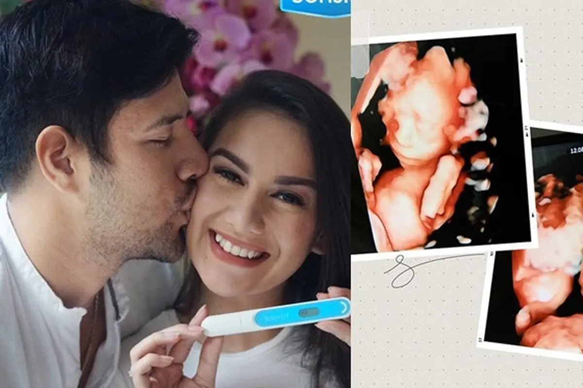 7 Potret Perjalanan Kehamilan Irish Bella Sebelum Bayi Kembarnya Meninggal