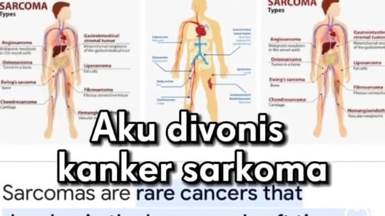 Kanker Sarkoma merupakan sebuah jenis kanker yang cukup langka dan berkembang di otot rahim.