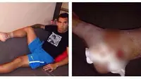 Ini Dia Bukti Cedera `Horor` Carlos Tevez