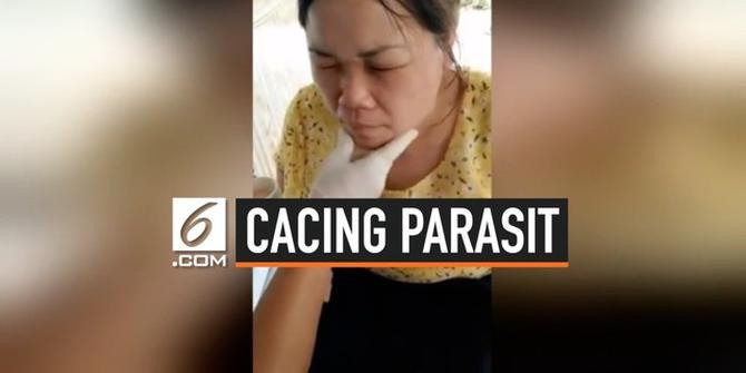 VIDEO: Ngeri, Puluhan Cacing Parasit Ditemukan Pada Wajah Wanita