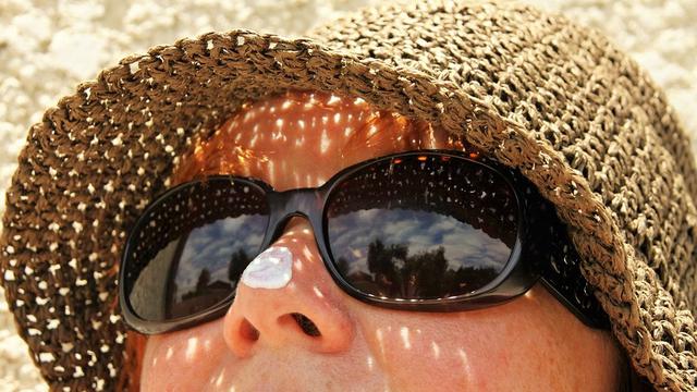 5 Area Tubuh yang Sering Tak Terlindungi Sunscreen