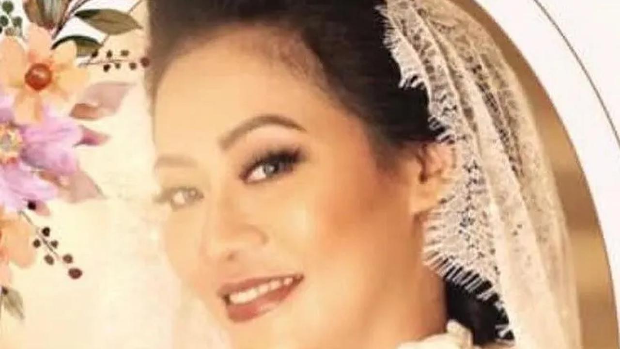 Polisi Bakal Libatkan MKDKI Selidiki Nanie Darham Usai Sedot Lemak