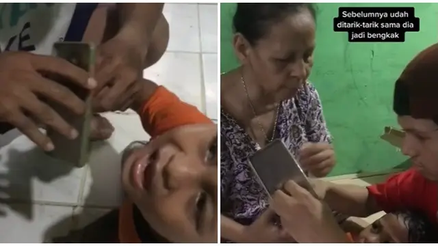 Bikin Panik, Jari Telunjuk Bocah Ini Nyangkut di Case Hp Sampai Dibawa ke Damkar