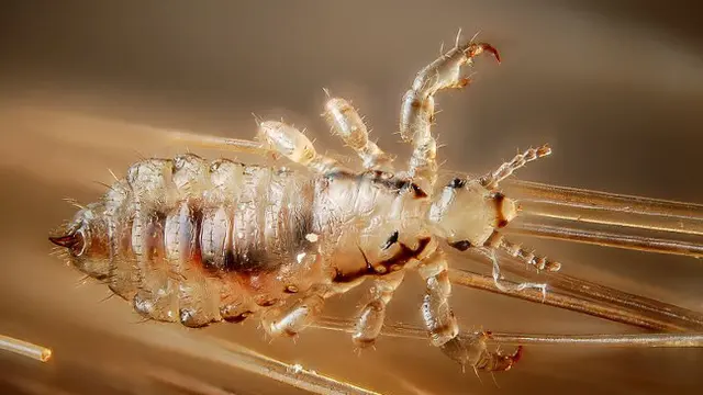 Karena Kutu Rambut, Wanita ini Sewa Tukang Pukul