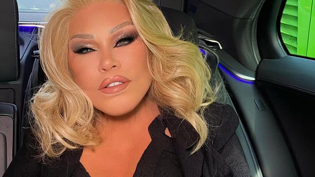 Jocelyn Wildenstein, Perempuan Berjuluk Catwoman Meninggal Dunia