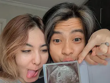 Arnold Leonard dan Moniq Crasivaya umumkan kabar kehamilan (Foto: Instagram arnoldleonard05)