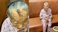 Viral Dahi Nenek 107 Tahun Ini Tumbuh Tanduk, Disebut Bikin Panjang Umur