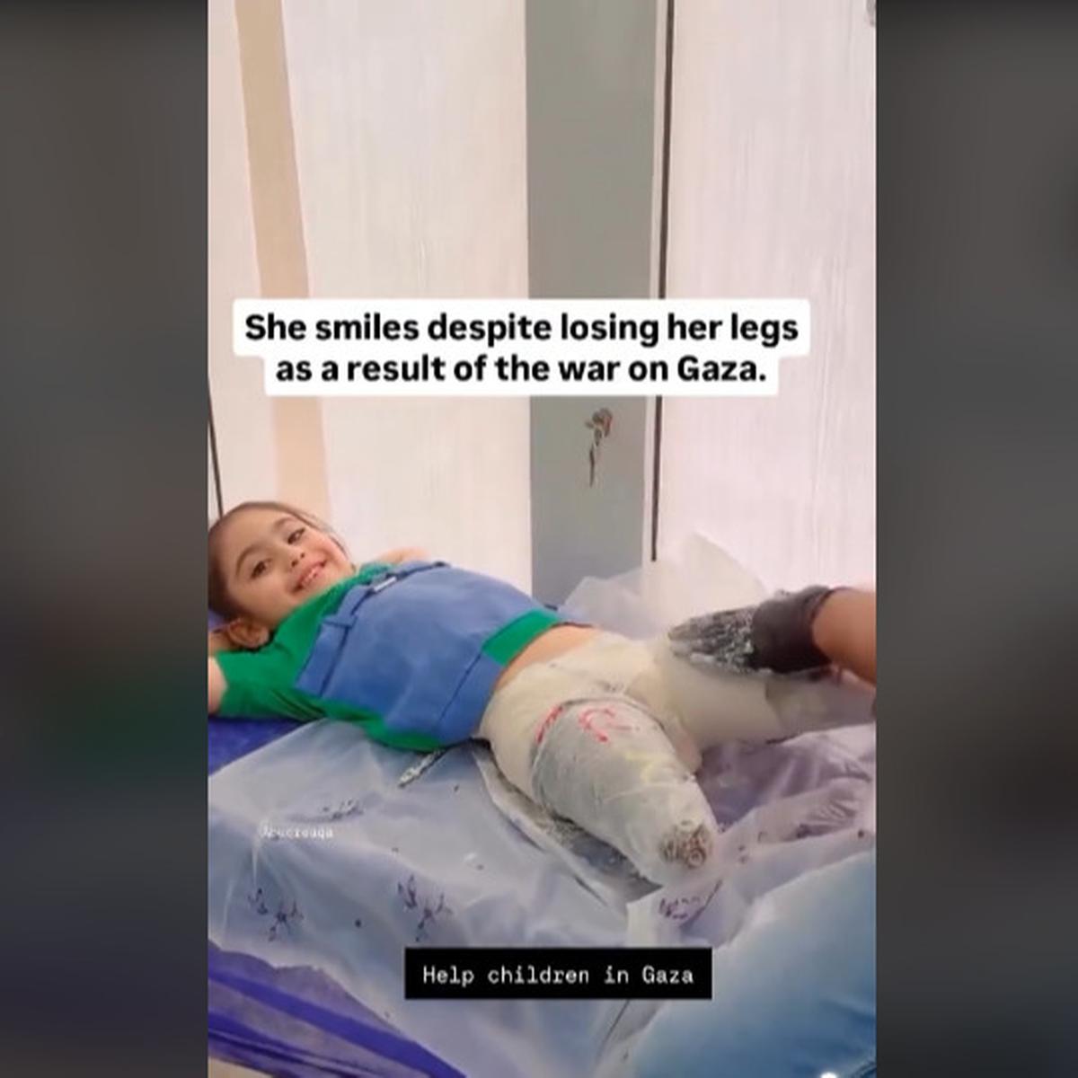 Sosok Luar Biasa Bocah Perempuan Palestina Masih Bisa Tersenyum Walau Kedua Kakinya Hilang Akibat Bom Israel