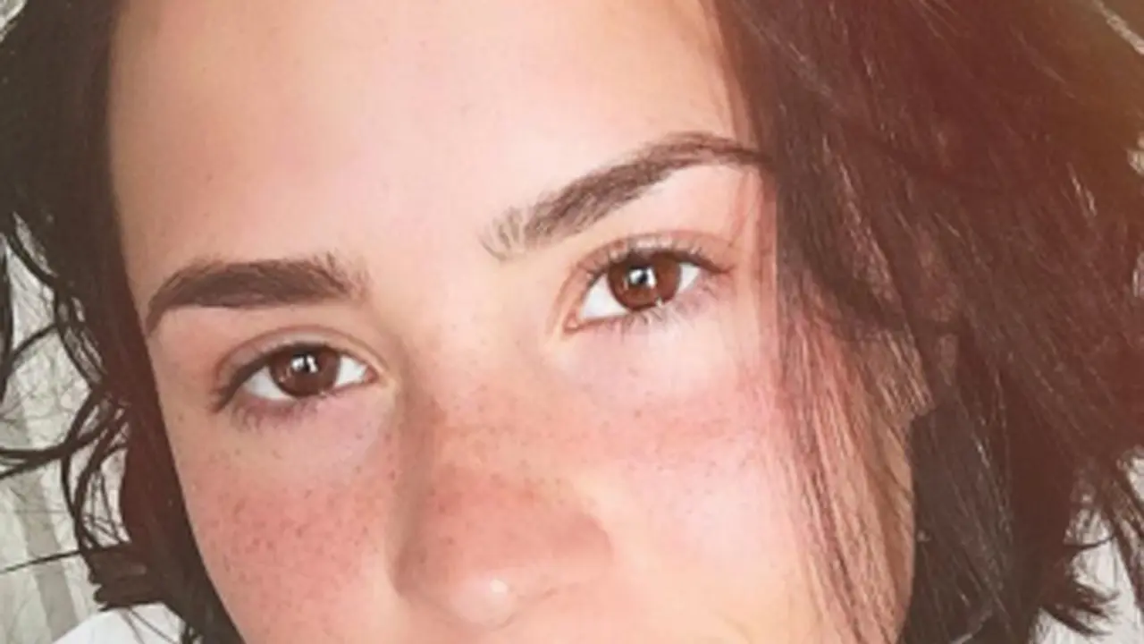 Sakit, Demi Lovato Dapat Dukungan dari Netizen