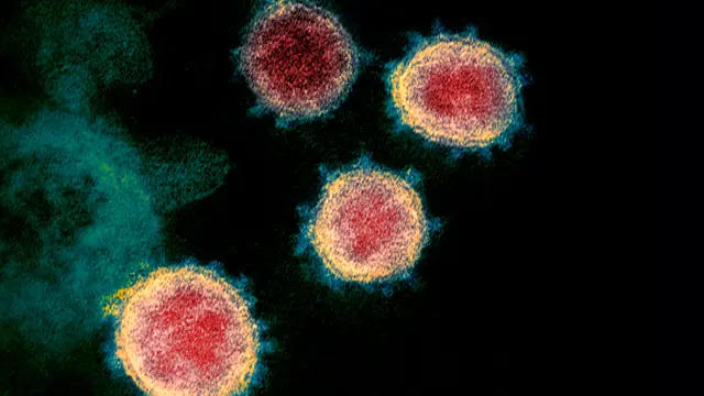 Virus Corona COVID-19 dari Mikroskop