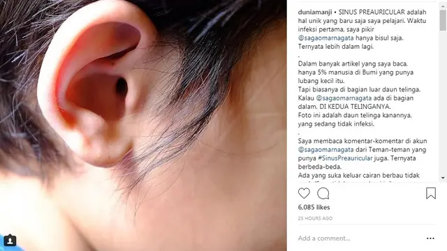 Anji (Foto: Instagram)