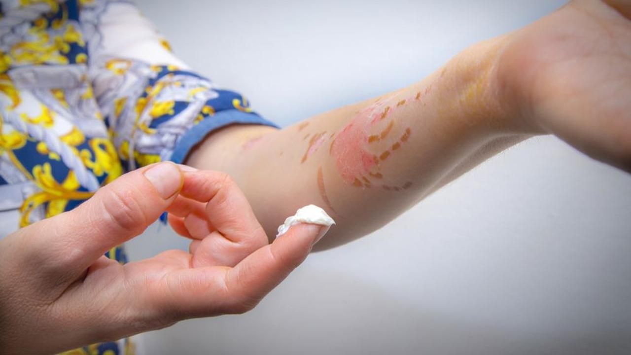 4. Gunakan Krim Antiseptik