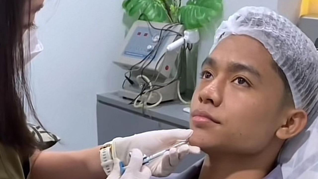 Betrand Peto, anak angkat Ruben Onsu dan Sarwendah belum lama ini melakukan perawatan filler dagu.