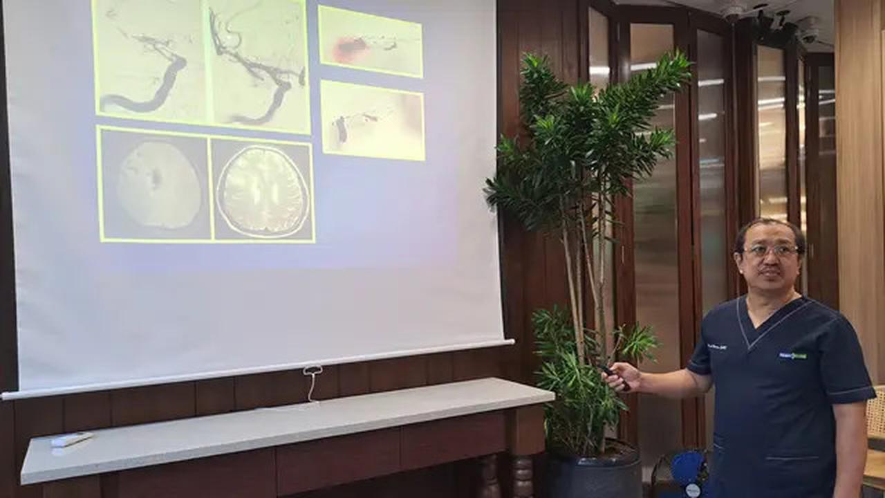 Sering Sakit Kepala Tiba-Tiba? Jangan Diremehkan Bisa Jadi Gejala Stroke Ringan