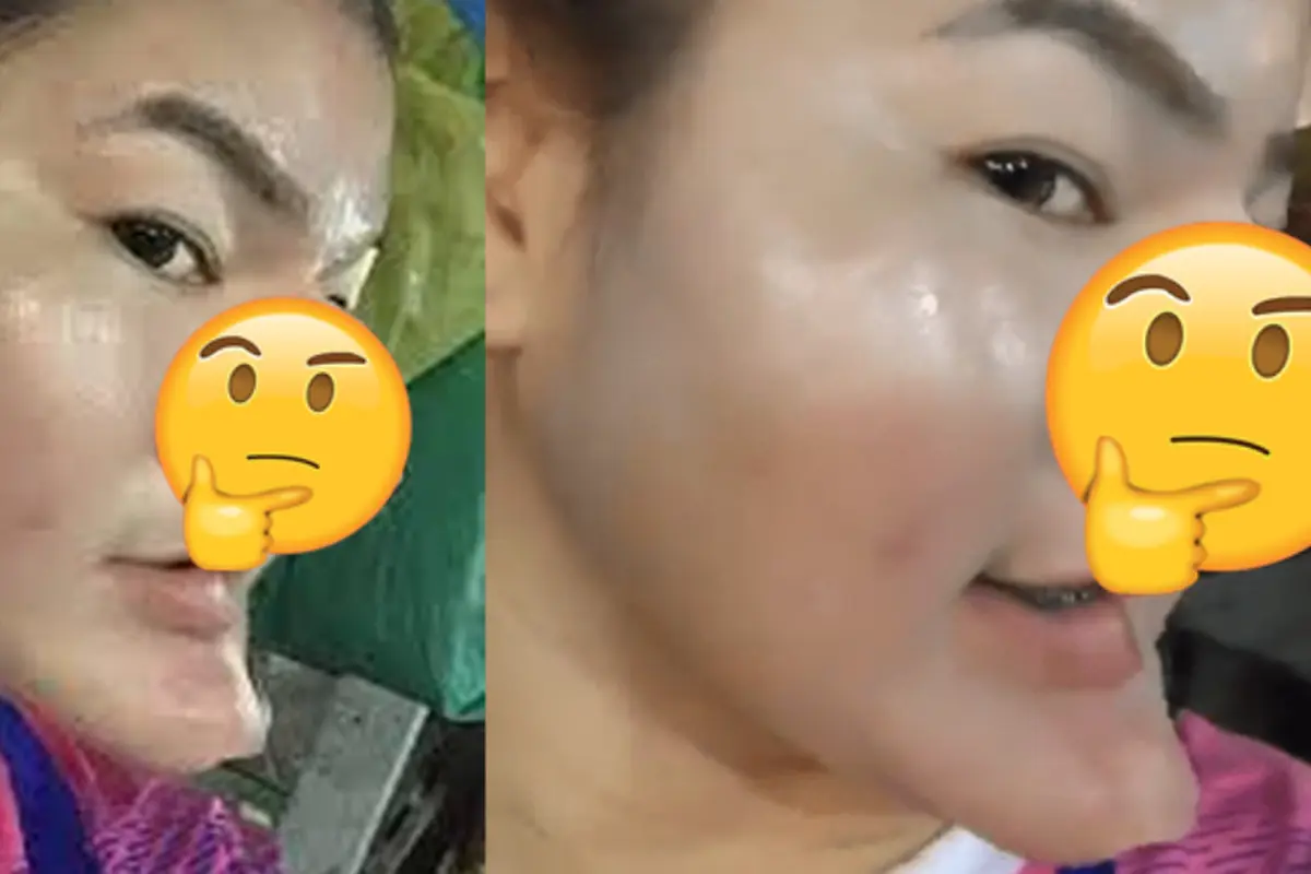 [Bintang] Mengaku Memiliki Banyak Uang dan Usai Operasi Plastik, Perempuan Ini Dibully Netizen