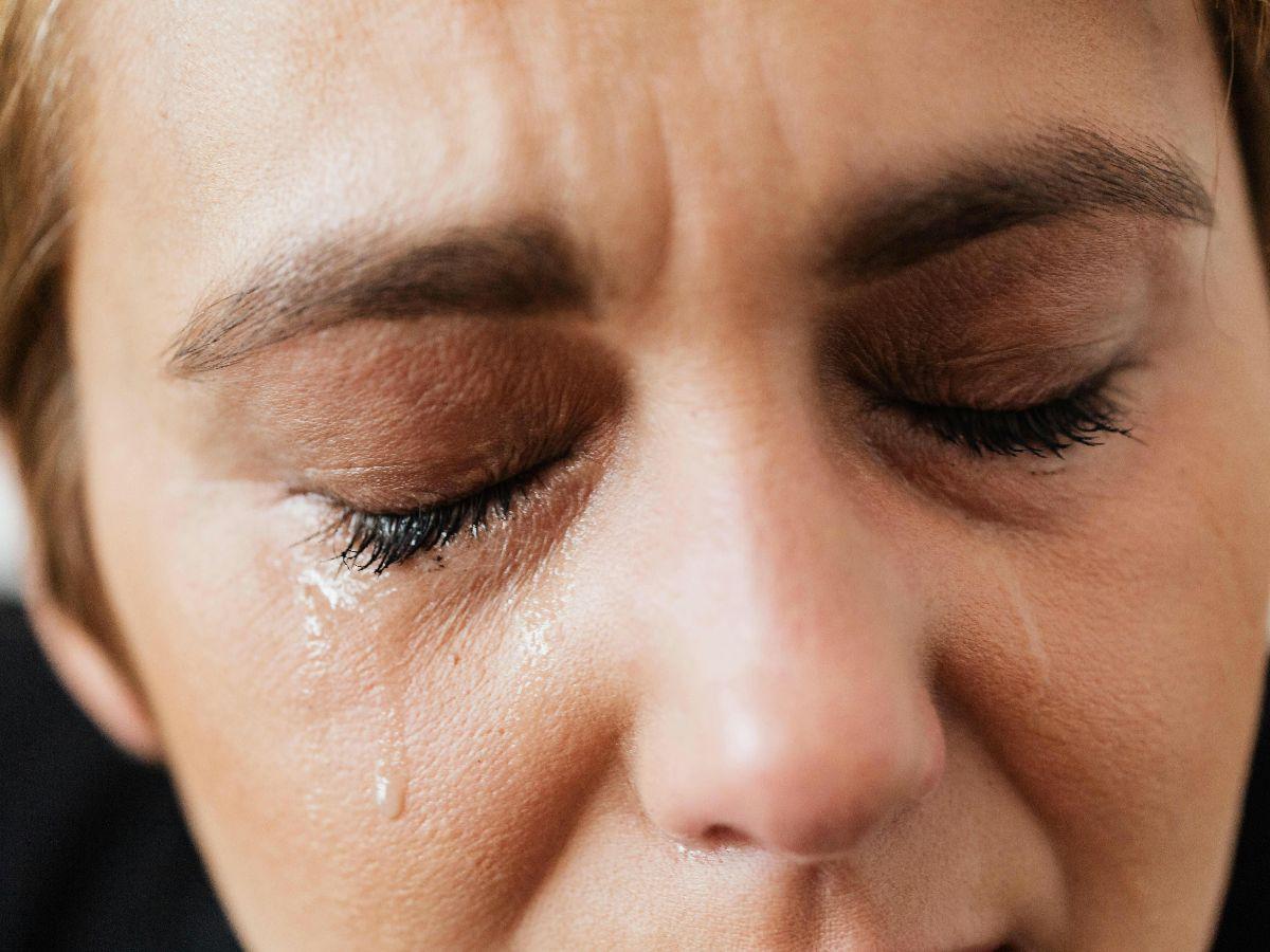 Cara Mencegah Penyakit Lupus
