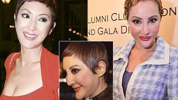 Foto: copyright yourhealth.asione