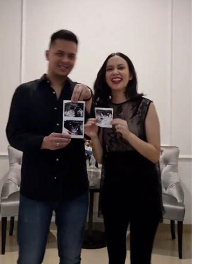 Hamil Anak Pertama, Ini 6 Potret Mesra Karina Nadila dan Suami