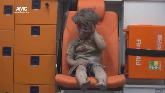 [Bintang] 4 Foto Memilukan dari Bocah 5 Tahun Korban Perang di Suriah