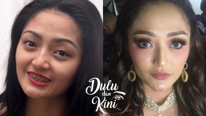 Dulu dan Kini: Transformasi Siti Badriah dari Biasa Banget ...