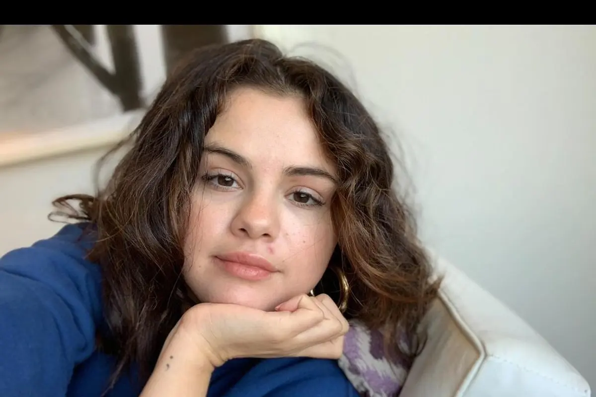 Selena Gomez Pamer Wajah Tanpa Makeup, Tetap Percaya Diri dengan Jerawat