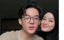 Rey Mbayang Jalani Operasi Plastik septorhinoplasty Alasan Demi Kesehatan