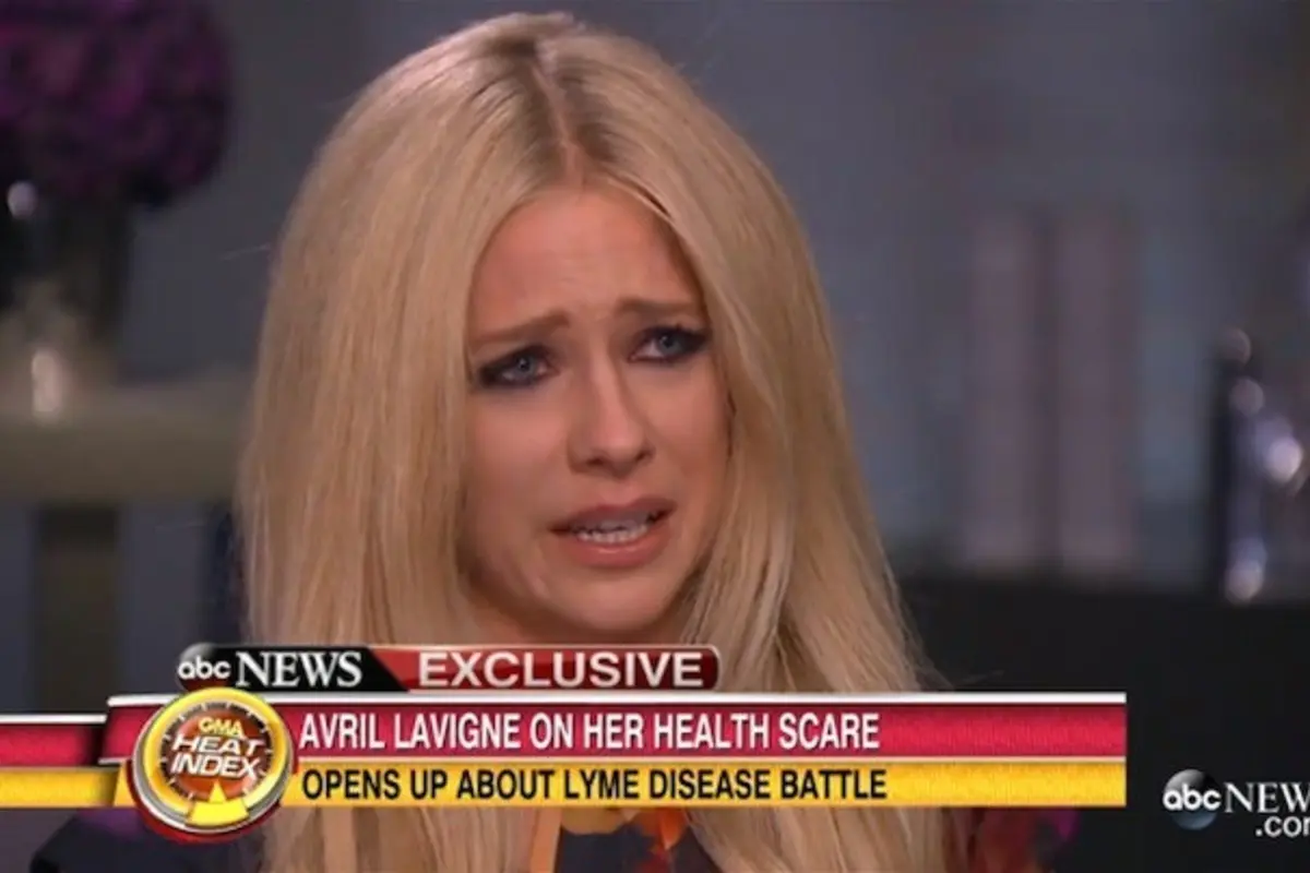 Dalam wawancara dengan Good Morning America, Avril Lavigne tak mampu menahan tangis saat menceritakan tentang penyakitnya.