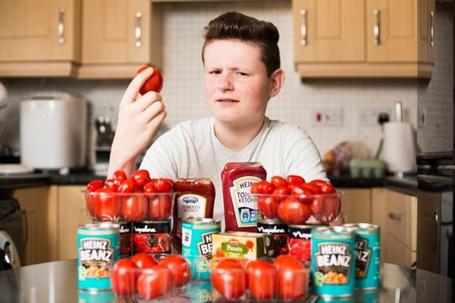 Selama 12 tahun Liam hanya mau makan buah tomat | Photo: Copyright mirror.co.uk