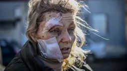 Seorang wanita yang terluka berdiri di luar rumah sakit setelah pemboman di Kota Chuguiv, Ukraina timur, 24 Februari 2022. Angkatan bersenjata Rusia mencoba menyerang Ukraina dari beberapa arah, menggunakan sistem roket dan helikopter untuk menyerang posisi Ukraina di selatan. (Aris Messinis/AFP)