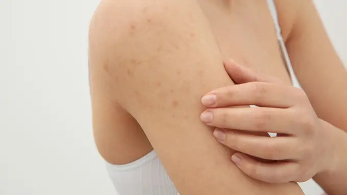skincare-kezo