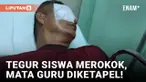 Tak Terima Anak Ditegur karena Merokok, Mata Guru di Bengkulu Diketapel Orangtua