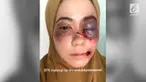 Sebuah akun melampirkan bukti jika memang foto wanita babak belur itu bukan ustazah yang dikabarkan babak belur.