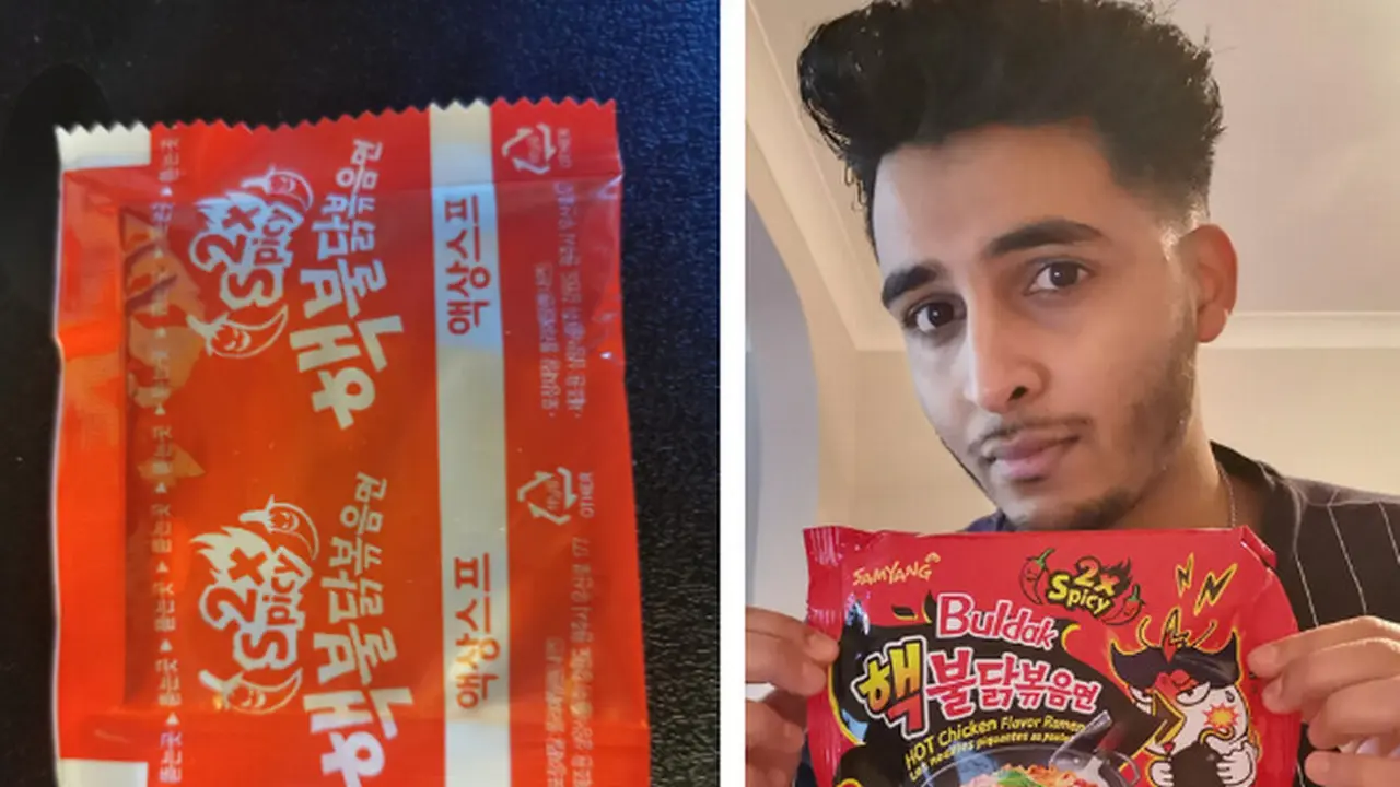 Kepedesan, Pria Ini Hampir Tuli Usai Makan Mie Samyang
