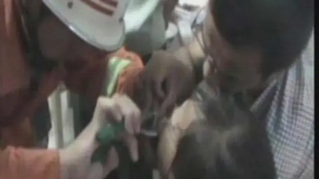 Penyelamatan Bibir Bocah China yang Terjepit Besi