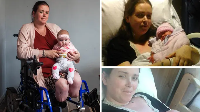 Usai Lahirkan Anak ke-8, Kedua Kaki Ibu Ini Terpaksa Diamputasi