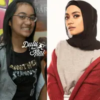 Seleb berkulit hitam manis ini semakin stunning setelah mantap berhijab. (Sumber foto: ayudiac/instagram)