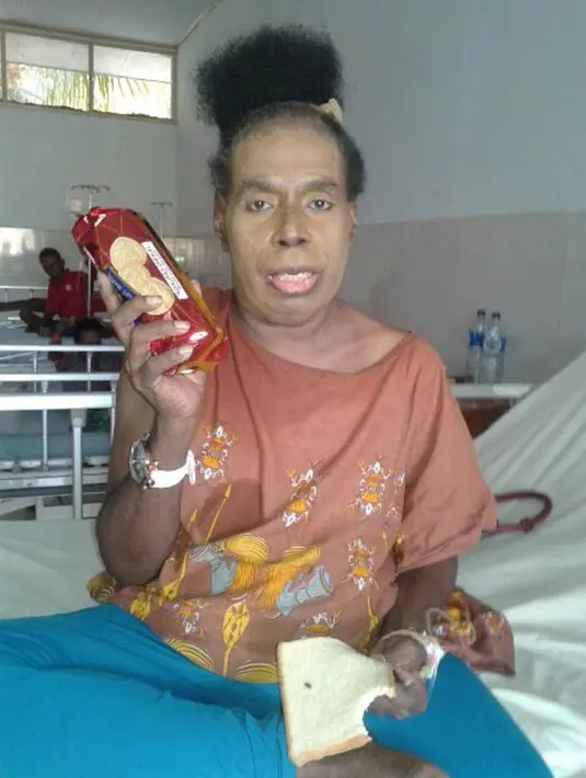 Rupanya, Ade bertolak ke Sorong, Papua, sejak satu bulan yang lalu. Selain untuk menjalani perawatan, Ade juga memilih menetap di Sorong demi bisa berkumpul dengan keluarga besarnya.  (Bintang Pictures)