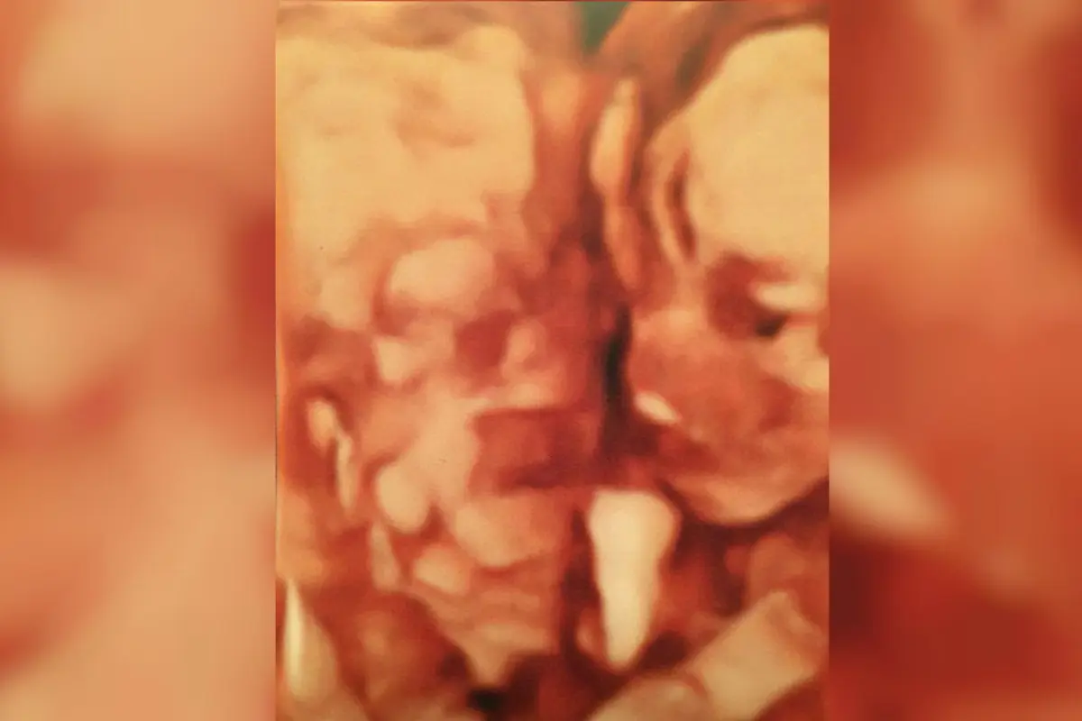 Calon Ibu Melihat Sosok Hantu Nenek Buyut dalam USG
