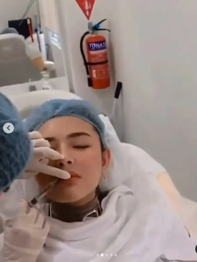 6 Potret Amanda Manopo Jalani Perawatan Wajah Suntik Dagu dan Pipi
