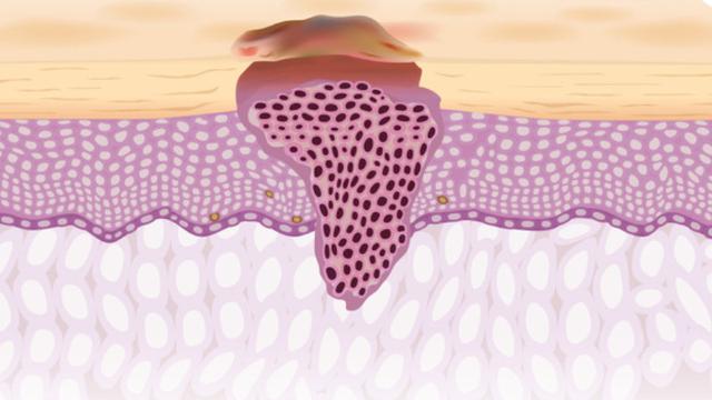 Masalah Kesehatan, 7 Perubahan pada Tubuh Anda Ini Harus Diperhatikan