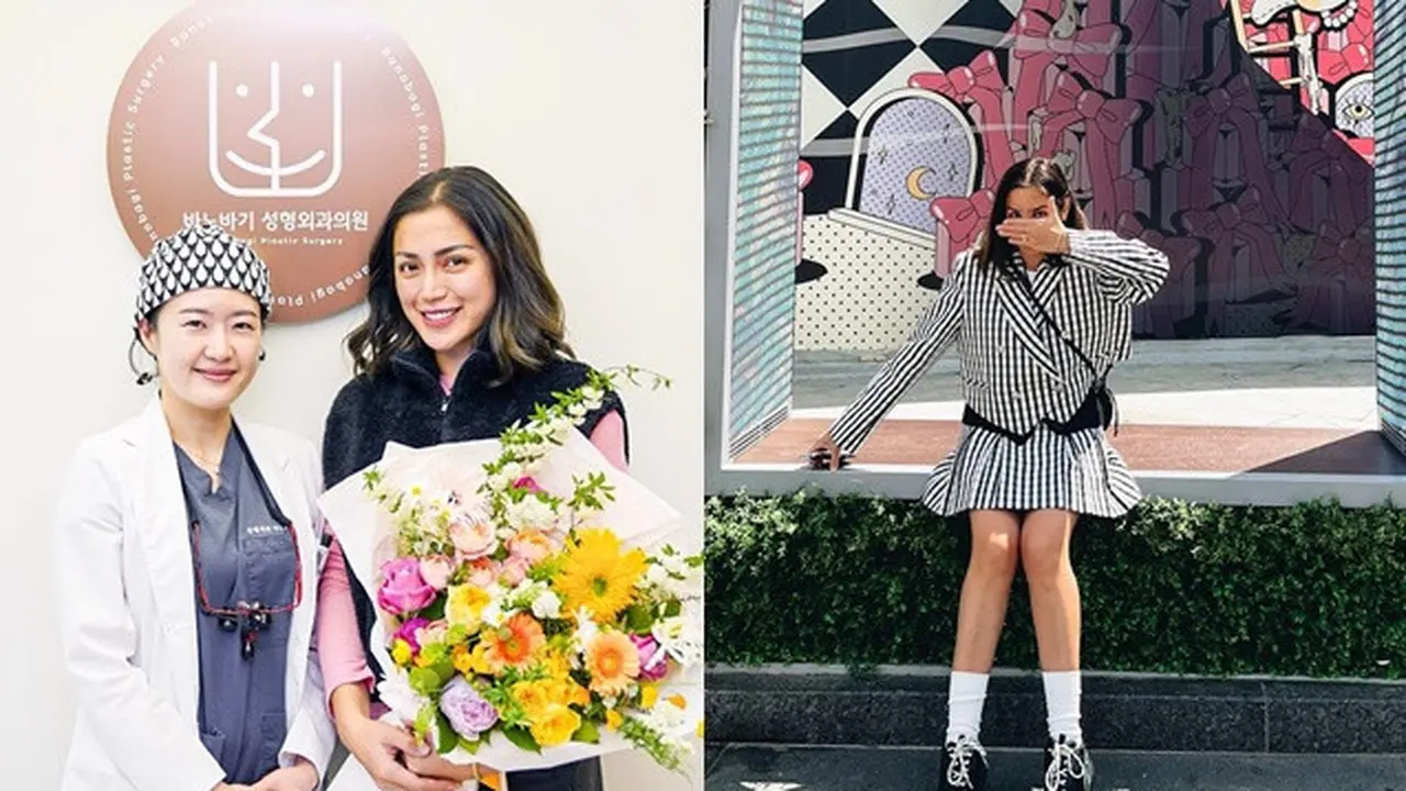 Masih Disembunyikan, Ini 6 Potret Jessica Iskandar Operasi Plastik Hidung