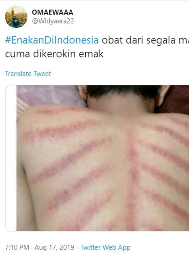 enakan di Indonesia